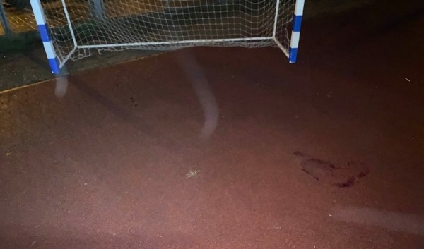 Минздрав рассказал о состоянии мальчика, травмированного футбольными воротами