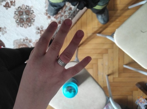 В Беларуси спасатели помогли снять застрявшее кольцо с пальца 8-летней девочки. Смотрите видео и фото