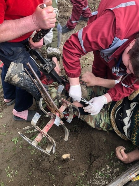 Спасатели освободили ногу мужчины из мотокультиватора