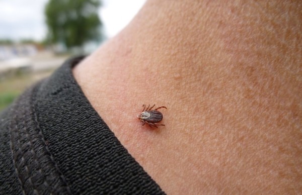 «Очень важно вовремя удалить клеща». Белорусский врач рассказал, как проявляется клещевой боррелиоз «Очень важно вовремя удалить клеща». Белорусский врач рассказал, как проявляется клещевой боррелиоз